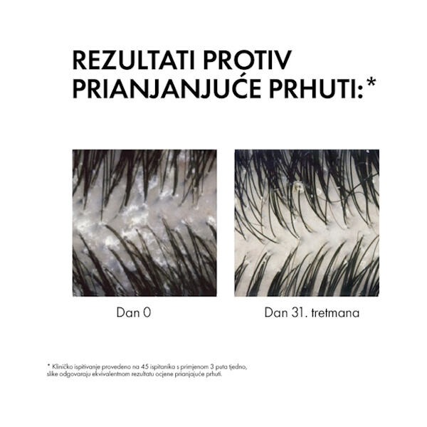 VICHY DERCOS ŠAMPON PROTIV PERUTI NORMALNA MASNA KOSA REFILL 390ML