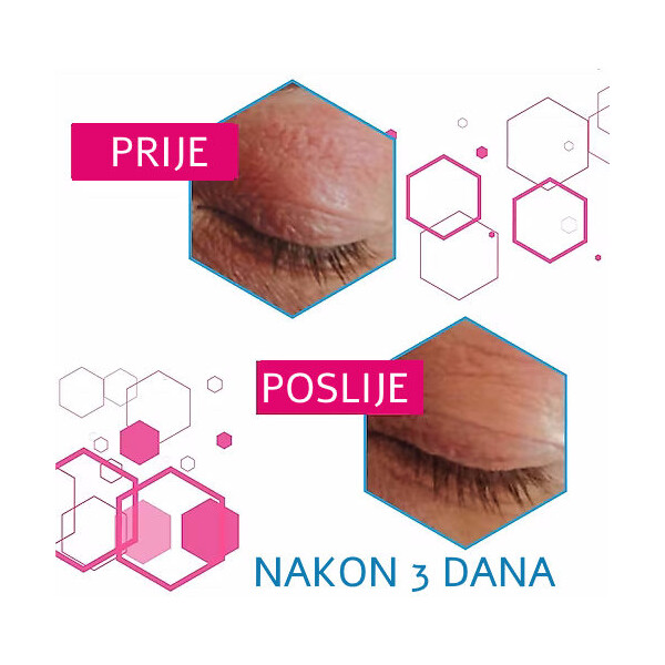 DEXYANE MED PALPBERAL KREMA 15ML DUCRAY