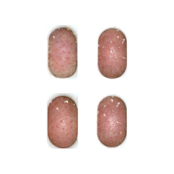 RIO UREĐAJ ZA ČIŠĆENJE PORA PORE PERFECTION