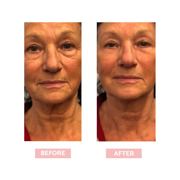 REMESCAR INSTANT KOREKTOR BORA 8ML