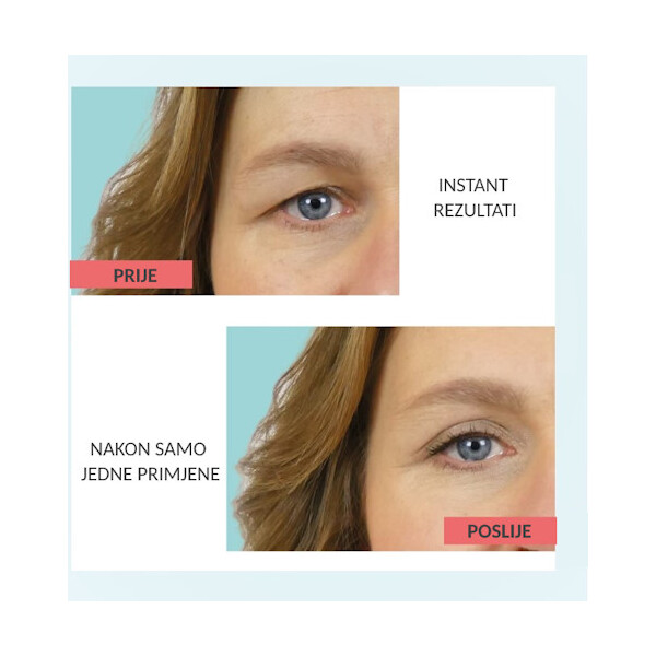 REMESCAR KREMA PROTIV SPUŠTENIH KAPAKA 8ML