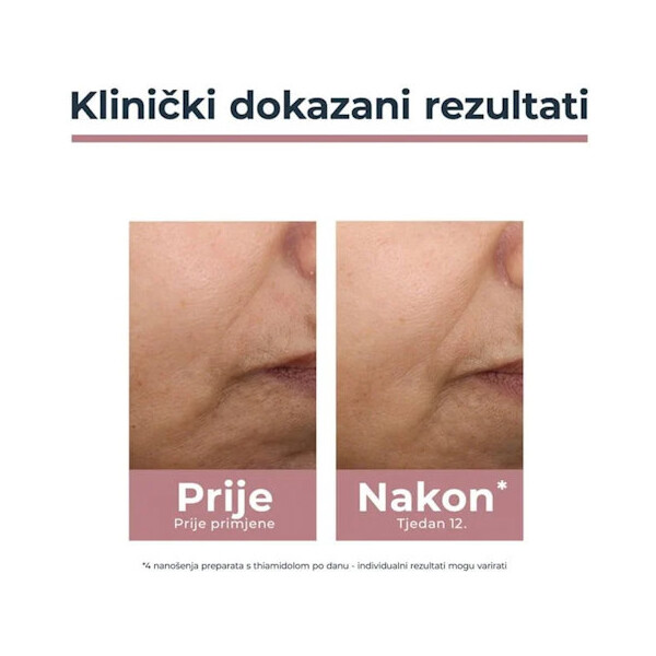 EUCERIN ANTI-PIGMENT DNEVNA KREMA SPF30