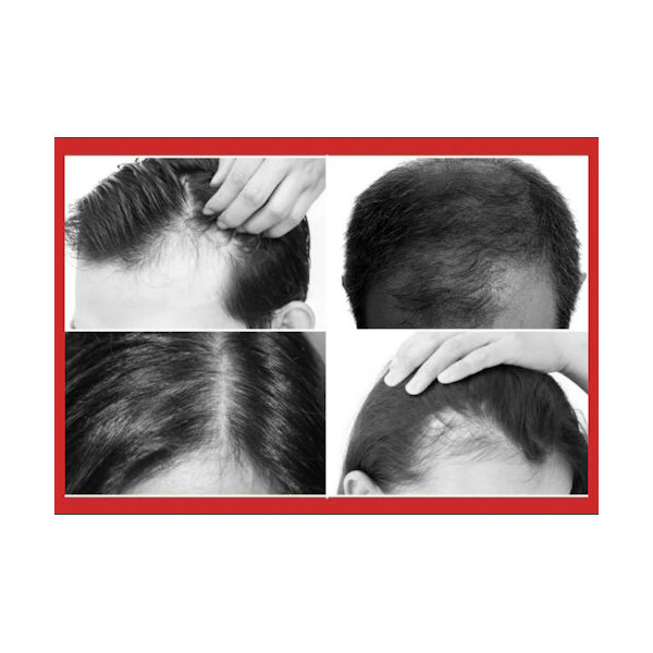 VITAL PLUS ANAGENIL COMPLEX CU SCALP CARE 40ML